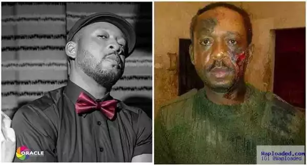 Photos: Nigerian Singer Battered By Soldiers For Wearing Camouflage